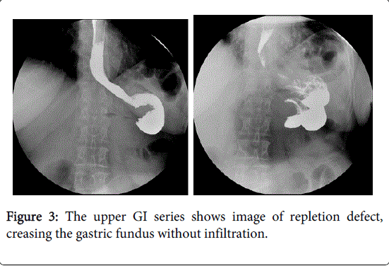 gastrointestinal-digestive-system-gastric-fundus