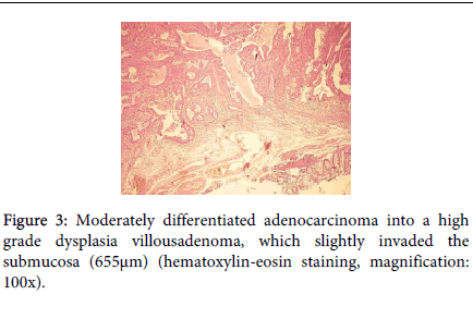 gastrointestinal-digestive-system-hematoxylin-eosin