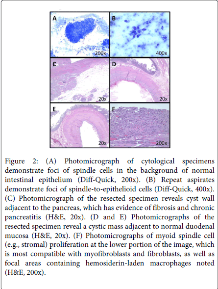 gastrointestinal-digestive-system-hemosiderin-laden