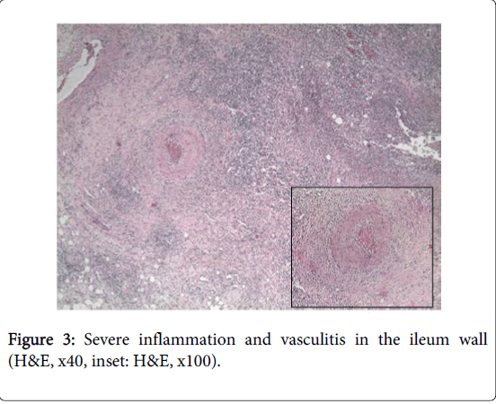 gastrointestinal-digestive-system-ileum-wall