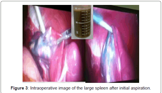 gastrointestinal-digestive-system-initial-aspiration