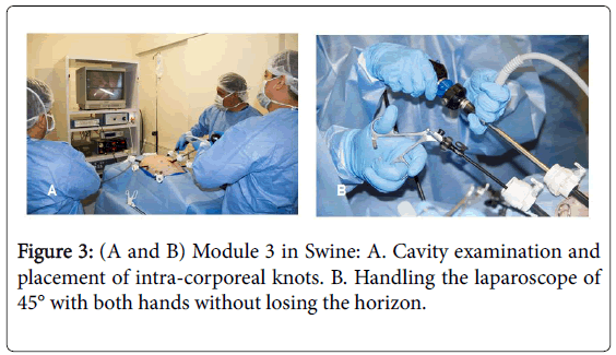 gastrointestinal-digestive-system-intra-corporeal-knots