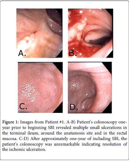 gastrointestinal-digestive-system-ischemic-ulceration