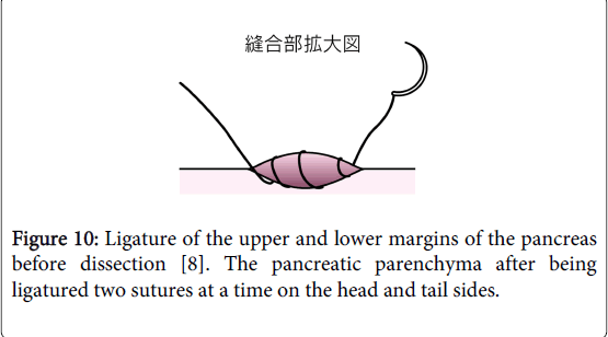 gastrointestinal-digestive-system-lower-margins