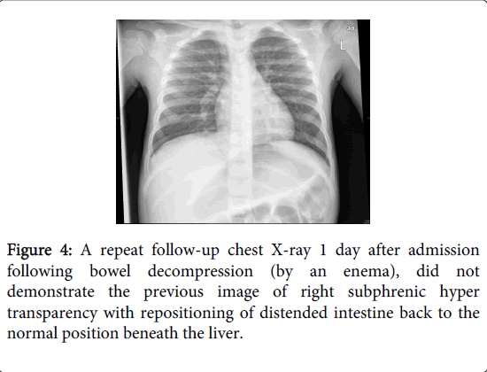 gastrointestinal-digestive-system-position-beneath