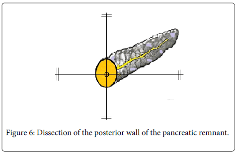 gastrointestinal-digestive-system-posterior-wall