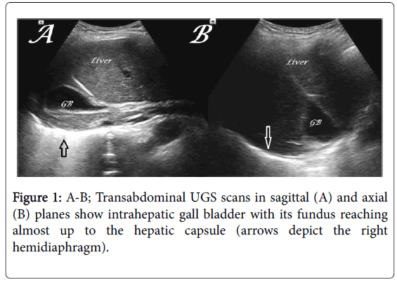 gastrointestinal-digestive-system-scans-sagittal