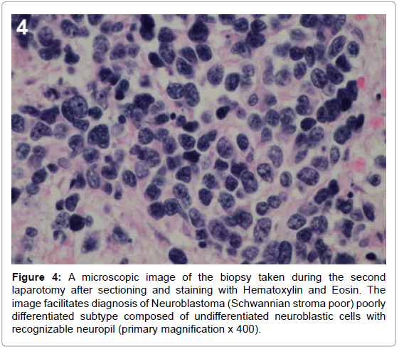 genetic-syndromes-gene-therapy-sectioning-staining