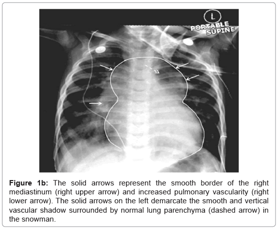 Health-care-reviews-pulmonary-vascularity