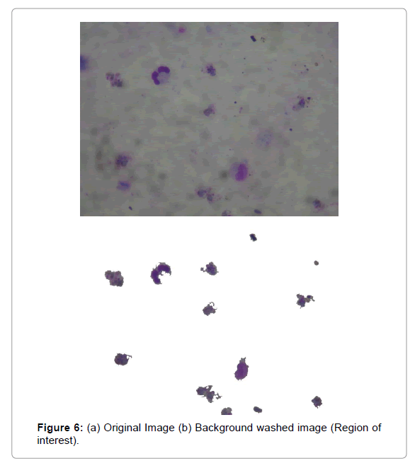 A Combined Algorithm for Malaria Detection from Thick Smear Blood Slides