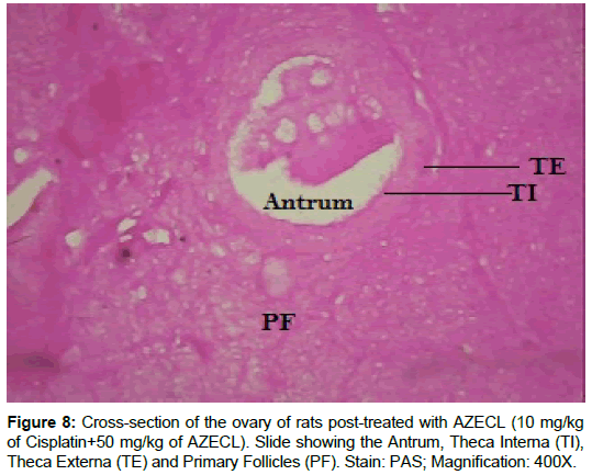 homeopathy-ayurvedic-Cross-section-ovary