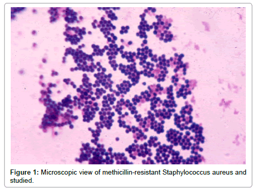 immunological-disorders-immunotherapy-Microscopic-view