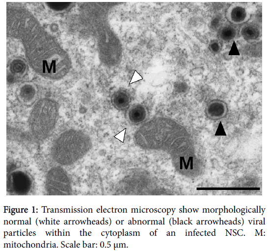 infectious-diseases-and-therapy-Transmission-electron