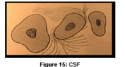 interdisciplinary-medicine-CSF