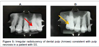interdisciplinary-medicine-Irregular-radiolucency-dental