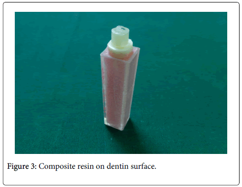 interdisciplinary-medicine-dental-science-Composite-resin