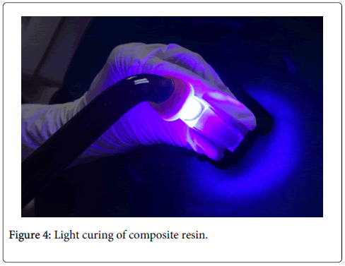 interdisciplinary-medicine-dental-science-Light-curing