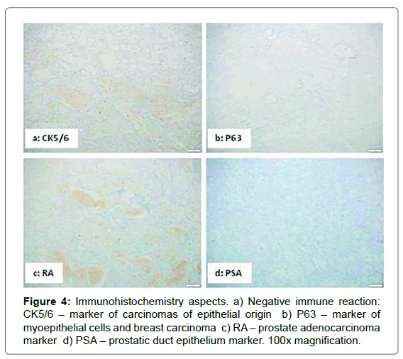 interdisciplinary-medicine-dental-science-Negative-immune