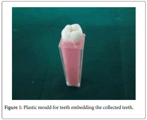 interdisciplinary-medicine-dental-science-Plastic-mould-teeth