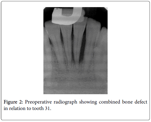 interdisciplinary-medicine-dental-science-Preoperative-radiograph