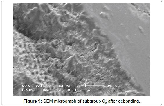 interdisciplinary-medicine-dental-science-SEM-micrograph-subgroup-C3