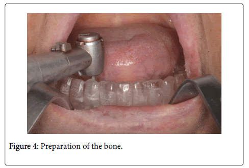 interdisciplinary-medicine-dental-science-bone