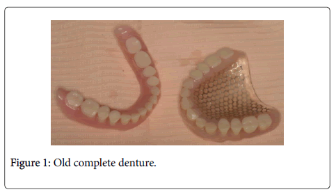 interdisciplinary-medicine-dental-science-denture