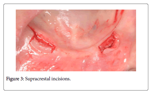 interdisciplinary-medicine-dental-science-incisions