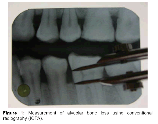 interdisciplinary-medicine-dental-science-loss-using-conventional