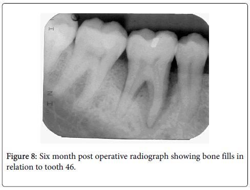 interdisciplinary-medicine-dental-science-operative-radiograph-showing