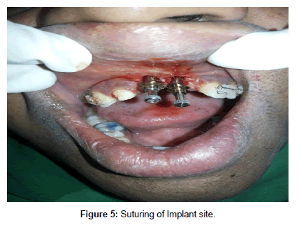 interdisciplinary-medicine-dental-science-suturing