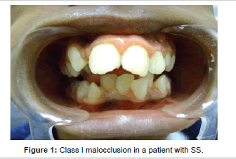 interdisciplinary-medicine-malocclusion-patient