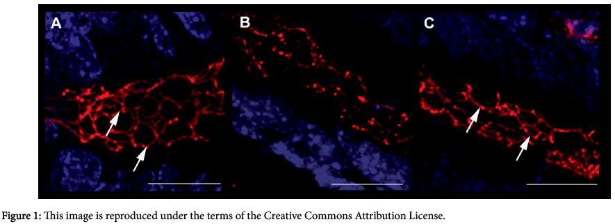 interdisciplinary-microinflammation-Commons-Attribution-License