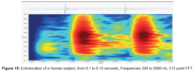 marine-science-research-development-Echolocation-Human-subject