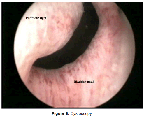 most embarrassing moments of a cystoscopy