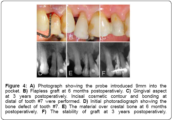 microbial-biochemical-technology-postoperatively