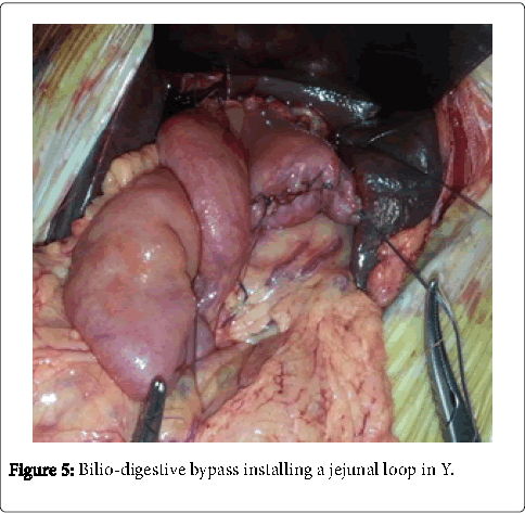 neonatal-and-pediatric-medicine-bilio-digestive