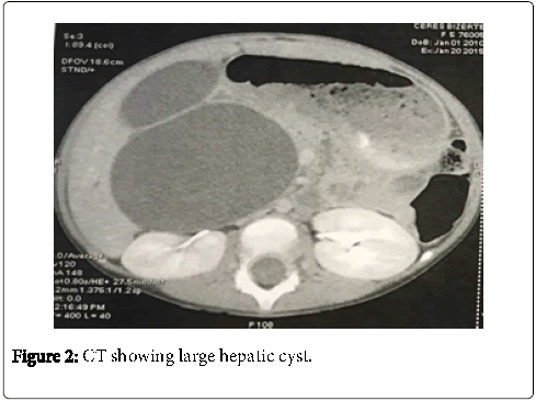 neonatal-and-pediatric-medicine-ct-showing