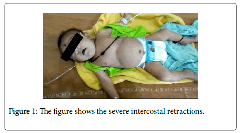 neonatal-and-pediatric-medicine-severe