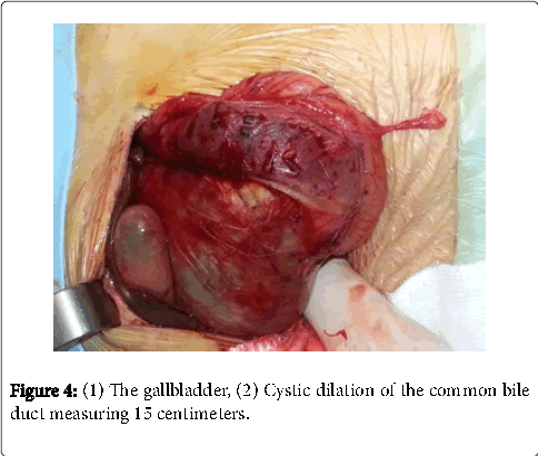 neonatal-and-pediatric-medicine-the-gallbladder