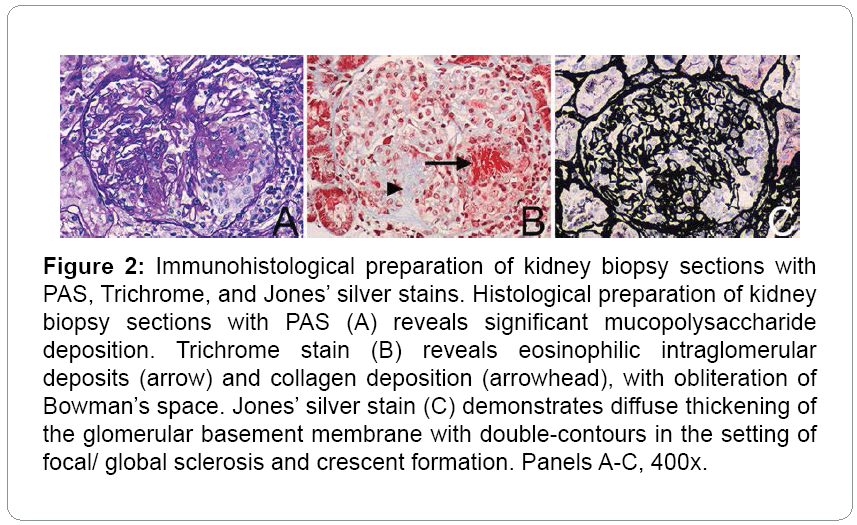 nephrology therapeutics Immunohistological 5 220 g002