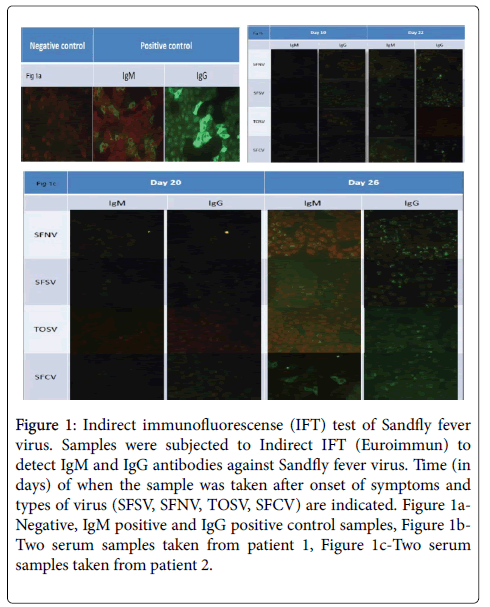 neuroinfectious-diseases-Indirect-immunofluorescense-test-Sandfly-fever-virus