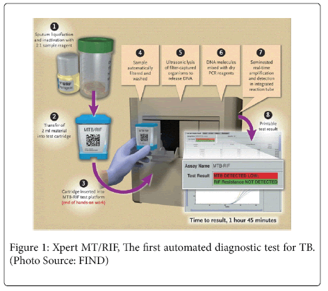 neuroinfectious-diseases-diagnostic-test