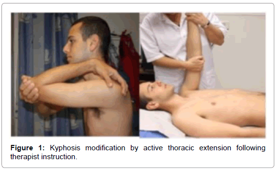 novel-physiotherapies-Kyphosis-modification-active-thoracic