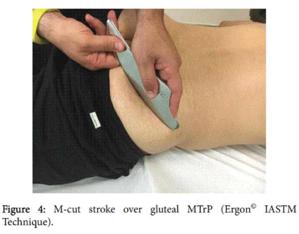 novel-physiotherapies-M-cut-stroke