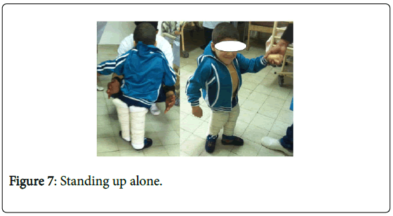 novel-physiotherapies-Standing-up-alone