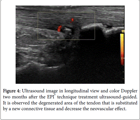 novel-physiotherapies-connective-tissue