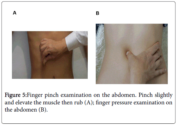 novel-physiotherapies-finger-pressure