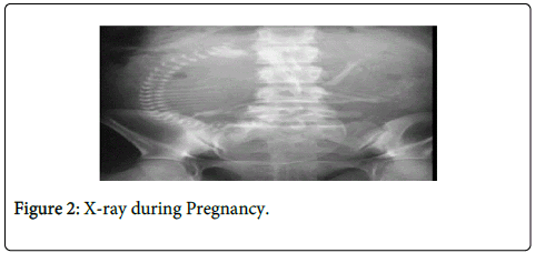 pregnant xray