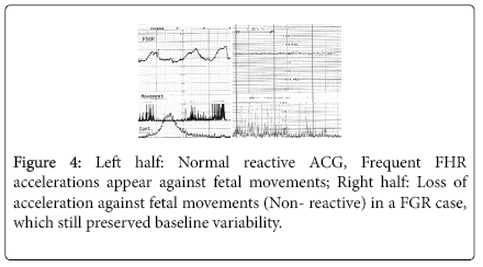 nursing-forensic-studies-Normal-reactive